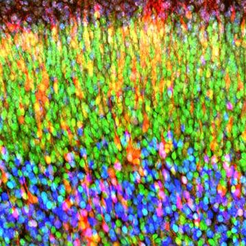 An example of a 'brainbow', where different neurons are visualised with coloured fluorescent proteins