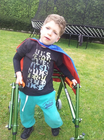 Ashton “Little Superman” Hancock, has hypoplasia of the corpus callosum, resulting in epilepsy and hearing impairment.
