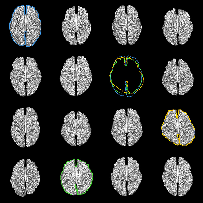 How does an optical illusion work? - Queensland Brain Institute -  University of Queensland