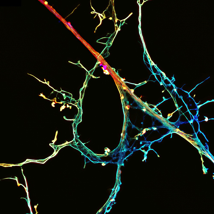 neurons connecting