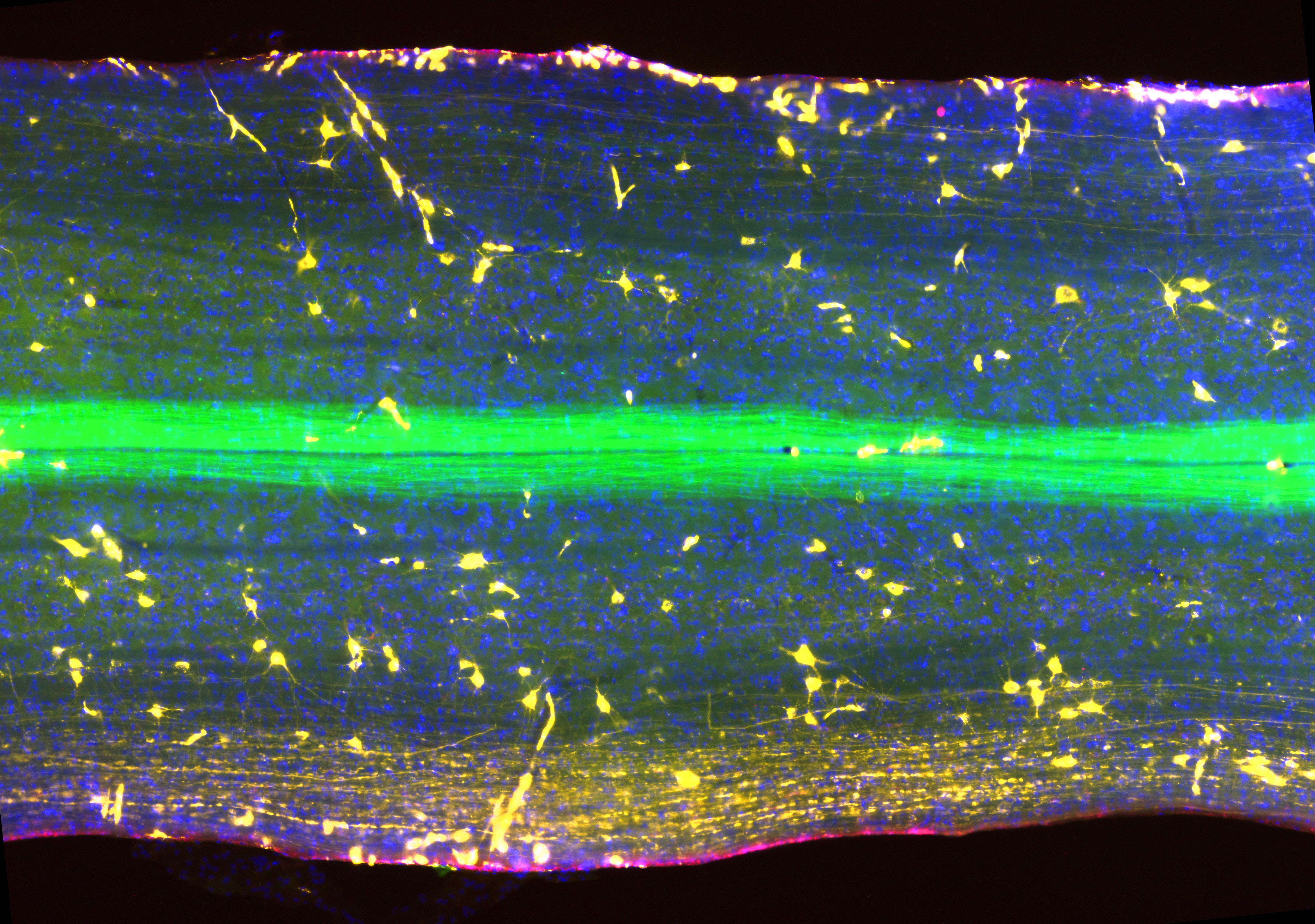 A candidate protein could keep motor neurons, the physical connections that link the brain to muscles, alive for longer in MIND.