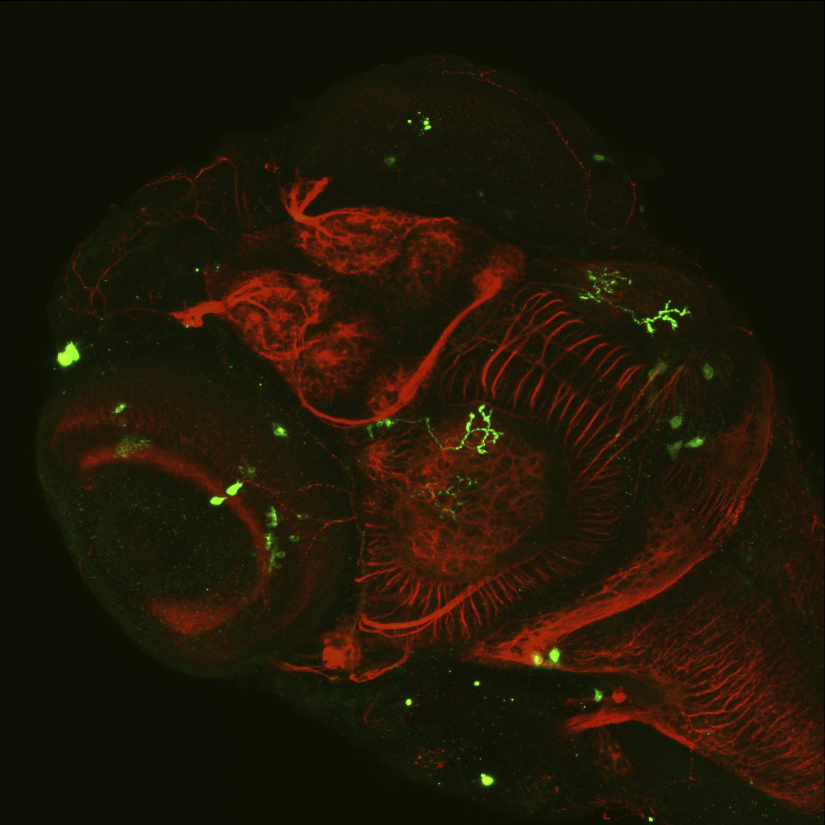 QBI researchers are applying advanced mathematical techniques to study connections in the brain.  