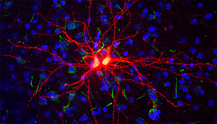 News-brain-cells-amygdala-QBI-700.jpg