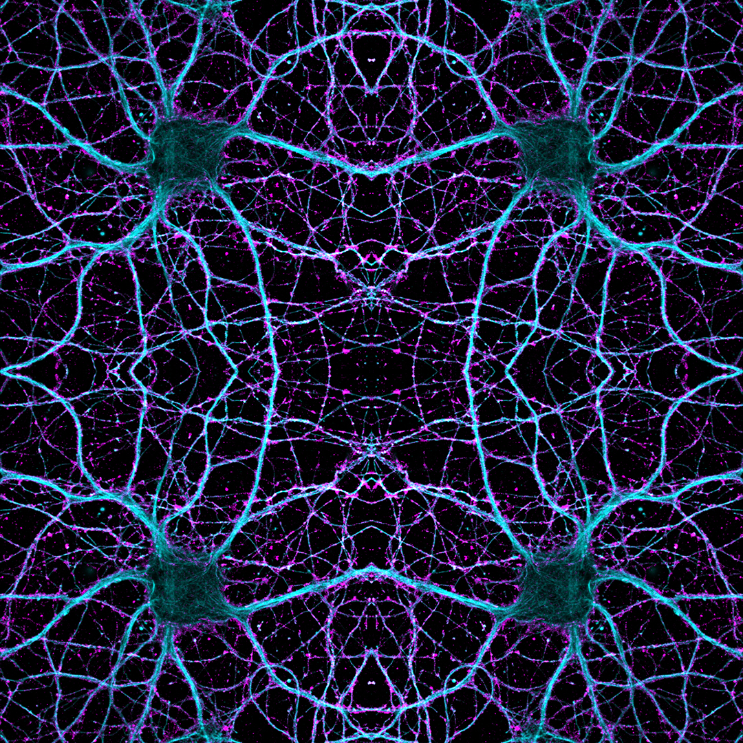neurons connecting