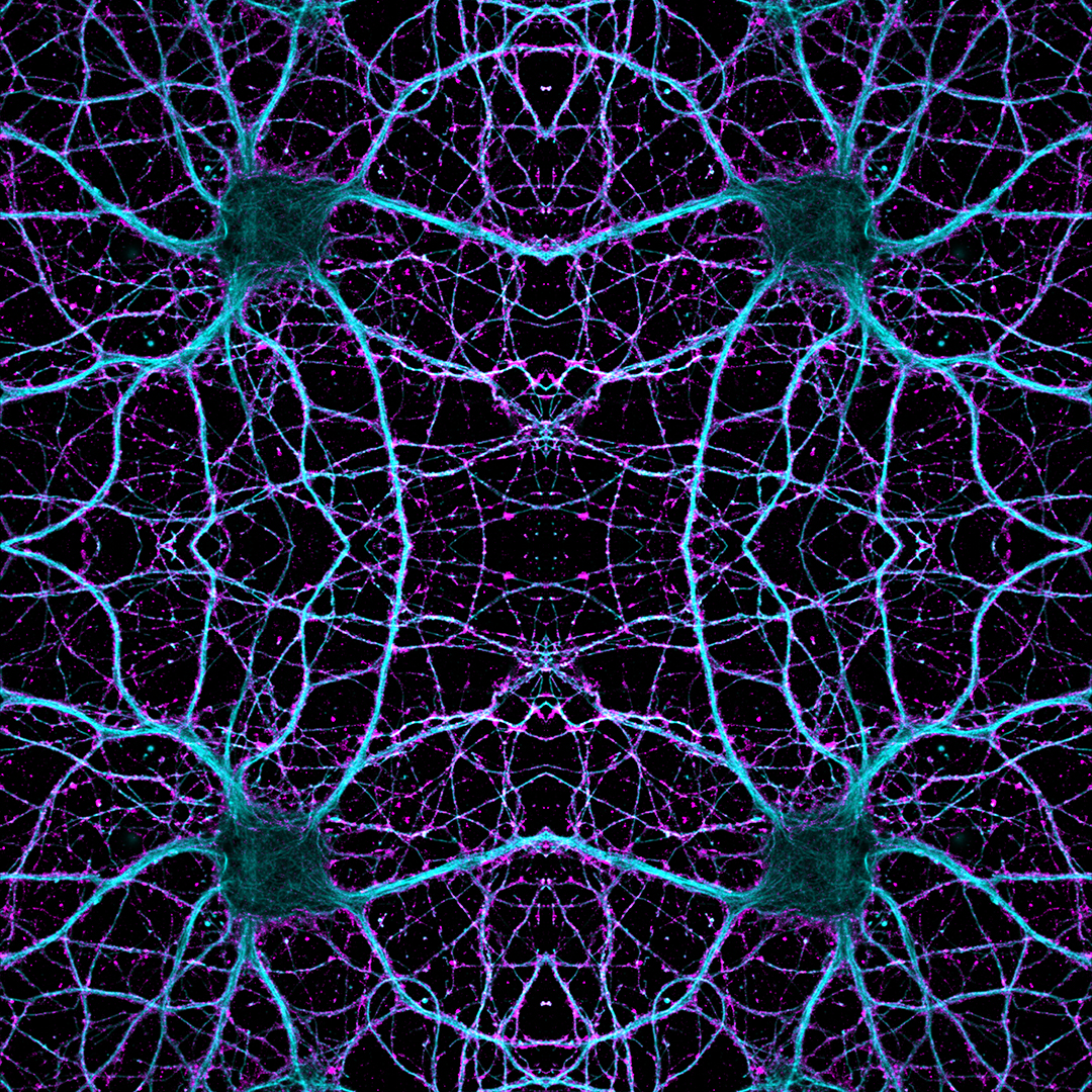 Neuron Is Shown On A Black Background, Nerve Cell Picture, Nerve, Brain  Background Image And Wallpaper for Free Download