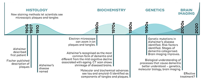 A timeline of Alzheimer's research