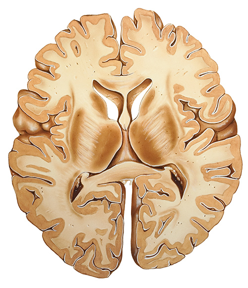 brain tissue layers