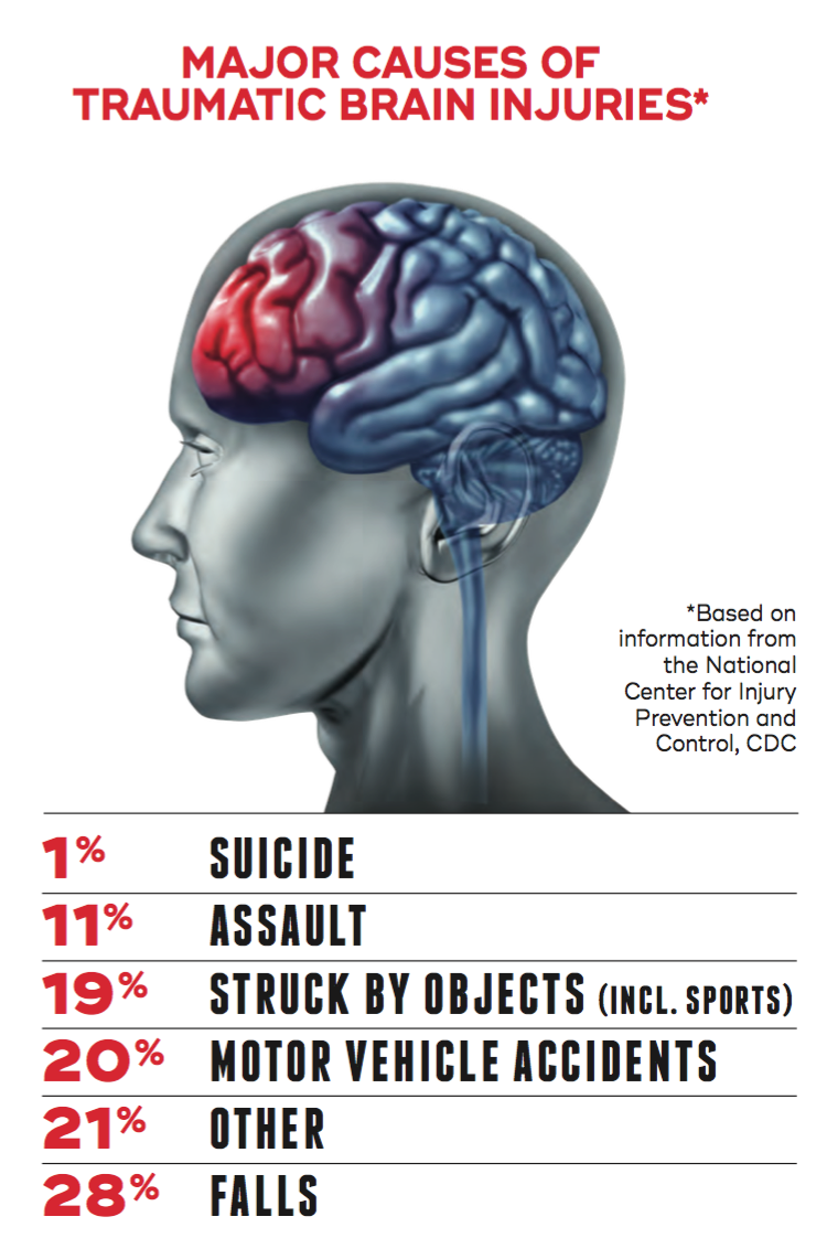 How to spot a concussion and what to do if you suspect a brain injury