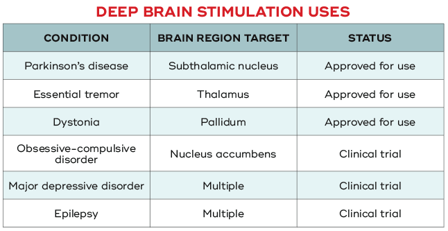 Deep Brain Stimulation uses