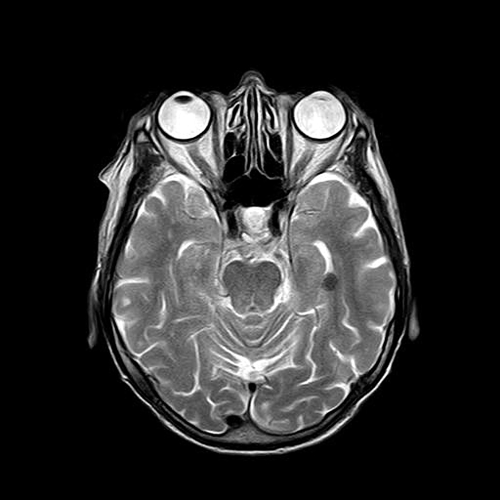 MRI scans were used to recognise the differences in brain shape or structure and accurately predict sex on that basis.