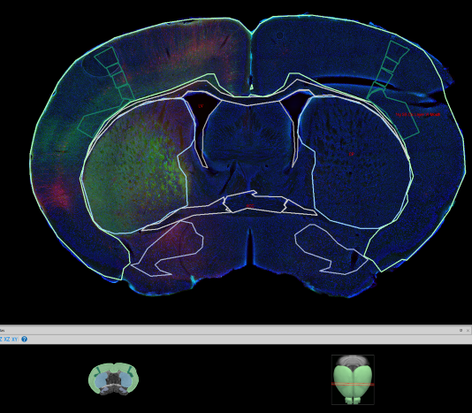 Neuroinfo