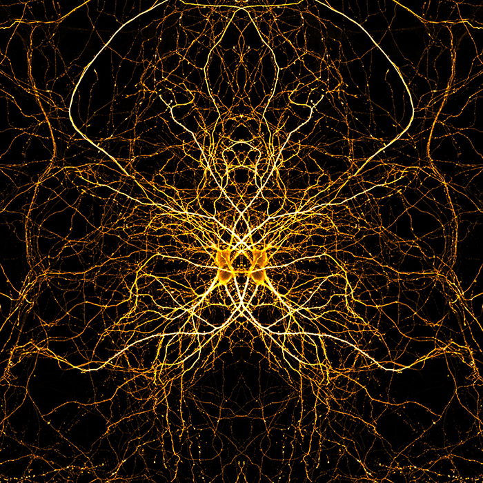 Neuronal Galaxy Guardian by Dr Belal Shohayeb