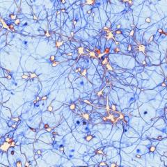 QBI researcher Dr Victor Anggono has won an award for his image of neuron growth