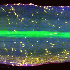 UQ researchers have discovered a potential MND drug target to delay disease onset and keep dying motor neurons alive for longer. 
