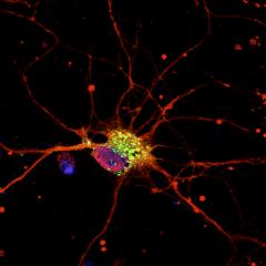 QBI research has identified the specific cause of a rare form of epilepsy in babies.