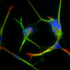 Can you grow new brain cells?