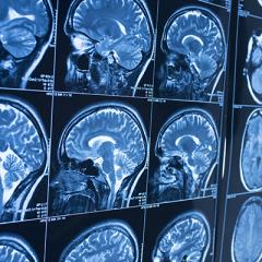 How injuries change our brain and how we can help it recover