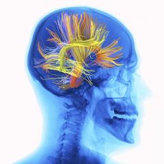 Diagnosing concussion with image tests