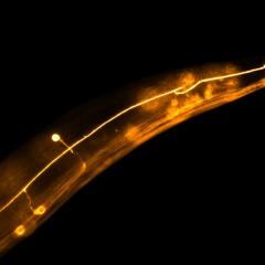 The tiny roundworm: a key player in brain science