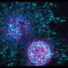 Neurogenesis in the brain