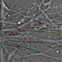 New research might bring a frown to even the most heavily botoxed faces, with scientists finding how some of the potent toxin used for cosmetic surgery escapes into the central nervous system.