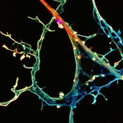 Two QBI neuroscientists have received prestigious awards to support their research.