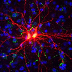 Emotion processing region produces new adult brain cells