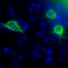 Perineuronal nets (bright green) surround particular neurons (blue). Fluorescence labelling reveals just how detailed these structures are. Image Credit: Phoebe Mayne, University of Queensland 