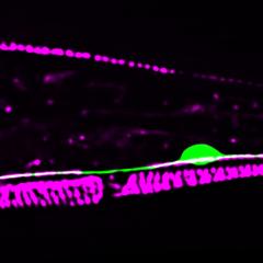 Microscopy image - attachment sites in the surrounding skin of roundworm nerve cells act as a glue, helping the cells remain intact during periods of strain. 