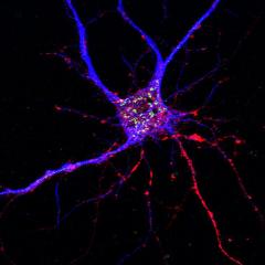 A potential drug target for Alzheimer’s disease has been discovered, affecting both neurons and brain immune cells.