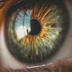 Researchers have studied how nerve cells in a rabbit’s eye respond differently to patterns of visual stimuli