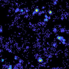 Newly discovered cellular hot spots of a potentially toxic protein could open new research avenues into how Alzheimer’s disease progresses in the brain.