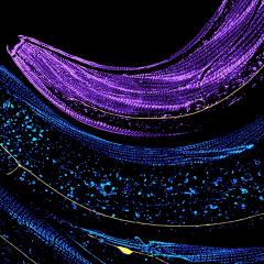 Researchers have revealed if touch-sensing neurons are attached to the surrounding skin correctly, they can avoid breakages and degeneration.