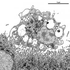 Ependymal cells lining the mouse ventricles