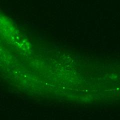 Queensland Brain Institute researchers have discovered two proteins in the transparent worm C. elegans that mediate how nerves degenerate.