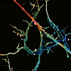 Stunning neuroscience images