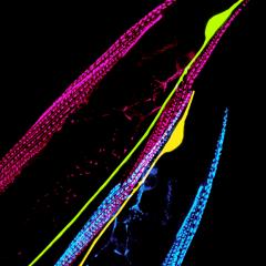 Researchers have identified a molecule essential for regulating the repair of injured nerves.